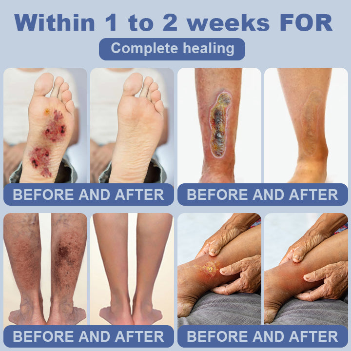Clinclii™ SugarSkin Repair Cream