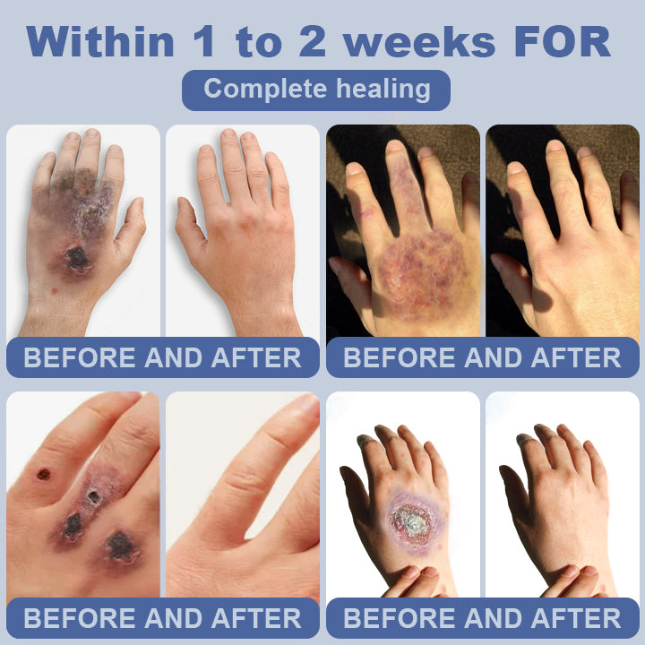 Clinclii™ SugarSkin Repair Cream