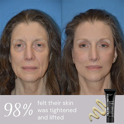 ⏰Last Day Sale 50% OFF🔥Instant Wrinkle Eye Tightener cream