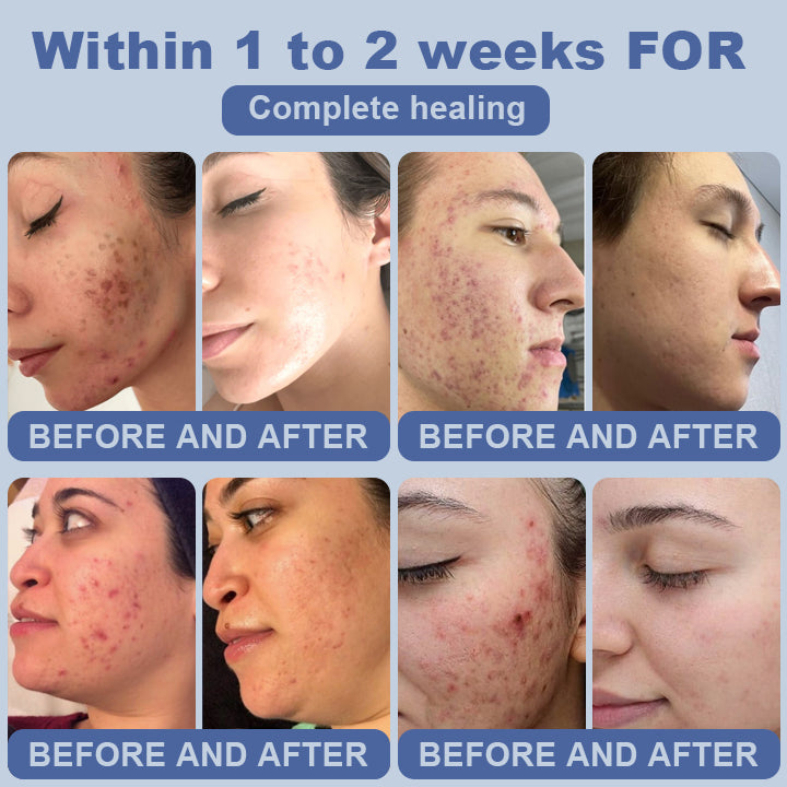 Clinclii™ SugarSkin Repair Cream