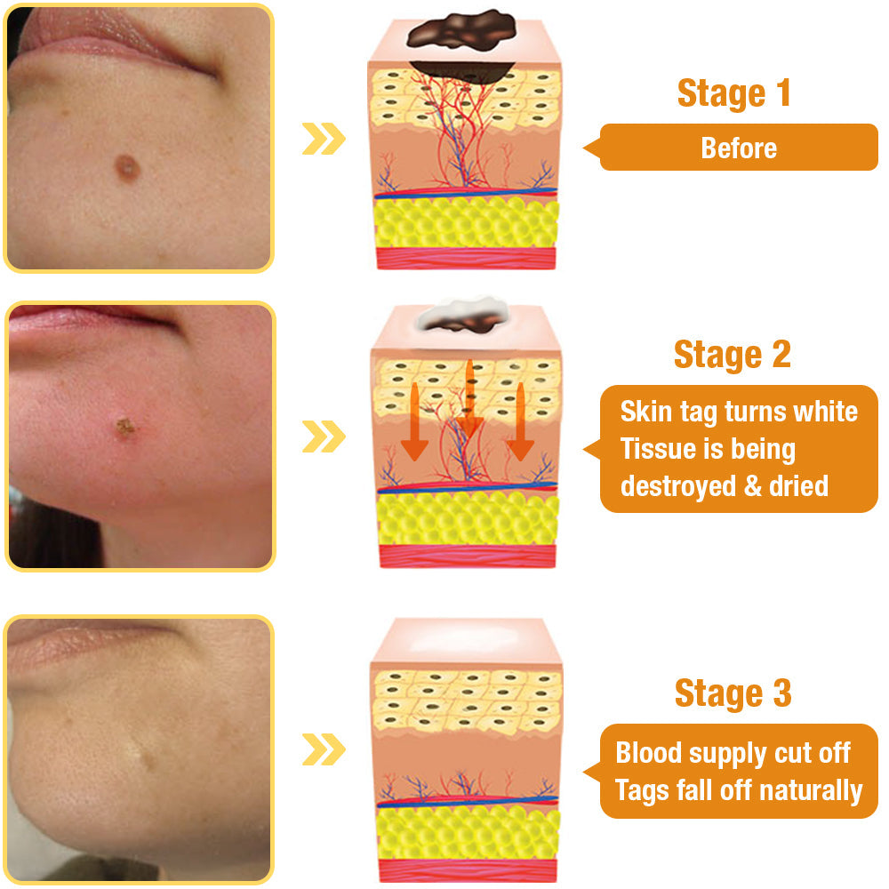 โจ๐๐๐ฌ๐ญ ๐๐๐ฒ ๐๐ข๐ฌ๐๐จ๐ฎ๐ง๐ญ: 87% ๐๐
๐
๐AQAโข TagRecede Bees Treatment Spray