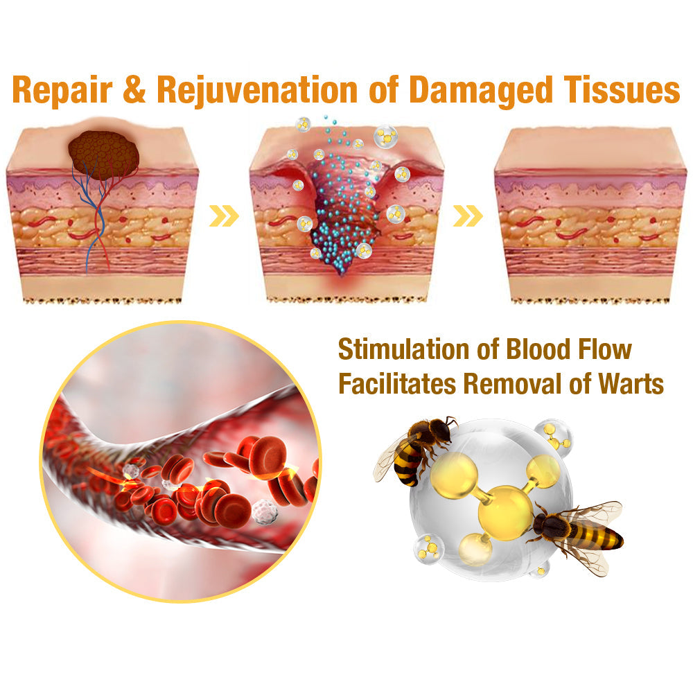 โจ๐๐๐ฌ๐ญ ๐๐๐ฒ ๐๐ข๐ฌ๐๐จ๐ฎ๐ง๐ญ: 87% ๐๐
๐
๐AQAโข TagRecede Bees Treatment Spray