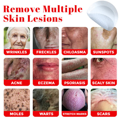 Alisanda™ MicroNeedle Plant-Based Skin Tag Removal Patch 🇺🇸 Made in the USA