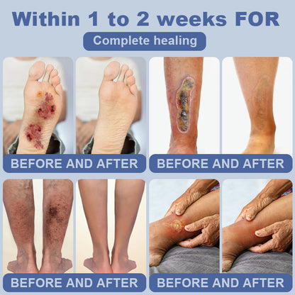 Clinclii™ SugarSkin Repair Cream