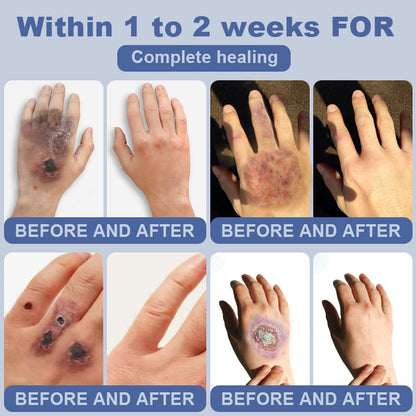 Clinclii™ SugarSkin Repair Cream