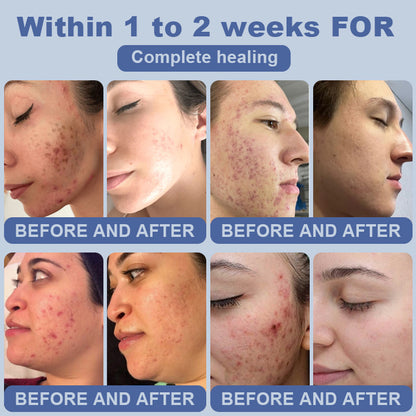 Clinclii™ SugarSkin Repair Cream