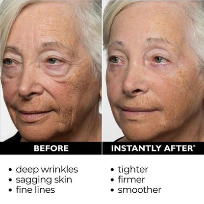 ⏰Last Day Sale 50% OFF🔥Instant Wrinkle Eye Tightener cream